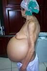 <b>Ascites</b>