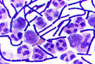 File:Gram Stain Anthrax.jpg - Wikipedia, the free encyclopedia