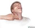 Neck pulse: MedlinePlus Medical Encyclopedia Image