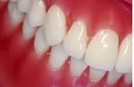 Take care of your gums | healthcaredir