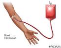 Jehovahs Witnesses - Position Overview | Bloodless Medicine Care Guide