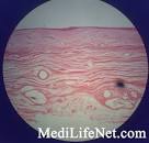 Vagaina-Histology - MediLifeNet