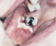 agranulocytosis - definition of agranulocytosis in the Medical ...