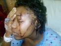 Carina Bernard, 18, of Bedford-Stuyvesant, was taken into custody for ... - images?q=tbn:ANd9GcSJI6taKtS2GsUq3epIlYtYhff50FZggvc41tIe_Vis863YTMAJZ0mAkfM