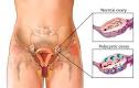 Plus, the <b>ovaries</b> make male