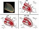 Ischemic heart disease - symptoms, causes, diagnosis and treatment ...
