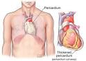 the <b>pericardial</b> layers and