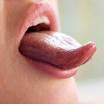 Le cancer de la <b>langue</b> est
