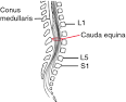 <b>Cauda equina</b>, descending from