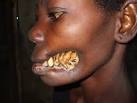 Malady Of The Month!