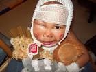 Wani Lemi, suffered burns