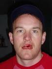 Fraters Libertas: Winter Sports Casualties Separated At Birth?