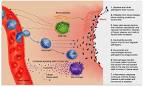 Natural Anti-inflammatory | Inflammation Relief Guide