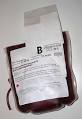 Blood transfusion - Wikipedia, the free encyclopedia