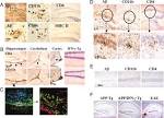 <b>meningoencephalitis</b> in