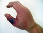 Venom in Colubrid Snakes - Reptile Forums