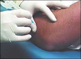elbow injection