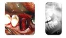Halitose, mauvaise haleine. Pathologies bucco-dentaires en rapport ...