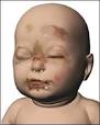 Computer graphics of Baby P's