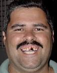 Truly bad teeth and the 10