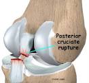Physical Therapy in California South Bay for Knee