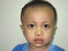 patient HAnef Abdul Samad