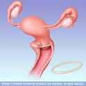 Mayo Clinic medical information and tools for healthy living ...