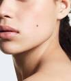 risk of melanoma.
