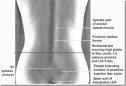 Surface Bony Landmarks | Medical School Lecture Notes – Trusted ...