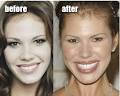 Nikki-Cox