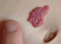 Red Mole: Red Mole Pictures