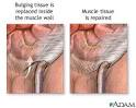 General Anesthesia | Stages-
