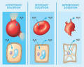 epiehonorsbiology - Hypotonic solution