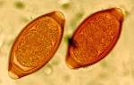 تریکوریس تریکیوریا <b>Trichuris</b>