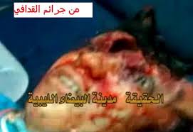 بالصور قصف طيران حربي على المتظاهرين السلميين في ليبيا ووقوع مجازر Images?q=tbn:ANd9GcSaTb8nT8RYDfEgWq8PjlHhLY-qLjYSVXlEEeplfM6-TRimwI6g