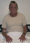 Chrysiasis: a gold “curse”! -- Ahmed and Sajjan 2009 -- BMJ Case ...