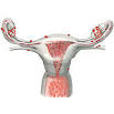 Manifestation of endometriosis