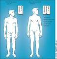 Klinefelter Syndrome - December 1, 2005 - American Family Physician