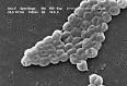 Acinetobacter - Wikipedia, the free encyclopedia
