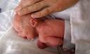 <b>DISEASE</b> OF <b>PRETERM</b> BIRTH