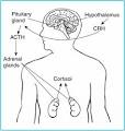 Cushing's Syndrome Page - National Endocrine and Metabolic ...