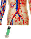 <b>Angiographie</b>