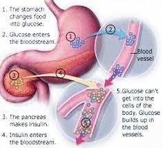 diabetes