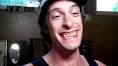 about fainting goats from