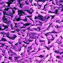 Campylobacter Resources : Campylobacter Blog : Food Poisoning ...