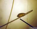 NIT on human hair: MedlinePlus Medical Encyclopedia Image