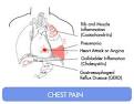 Chest Pain :: MedToGo International