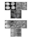 Fecal Contamination