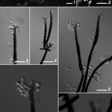 Результат пошуку зображень за запитом "Gilmaniella macrospora"