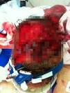 Ronald Poppo indentified as victim whose face was eaten in 'zombie ...